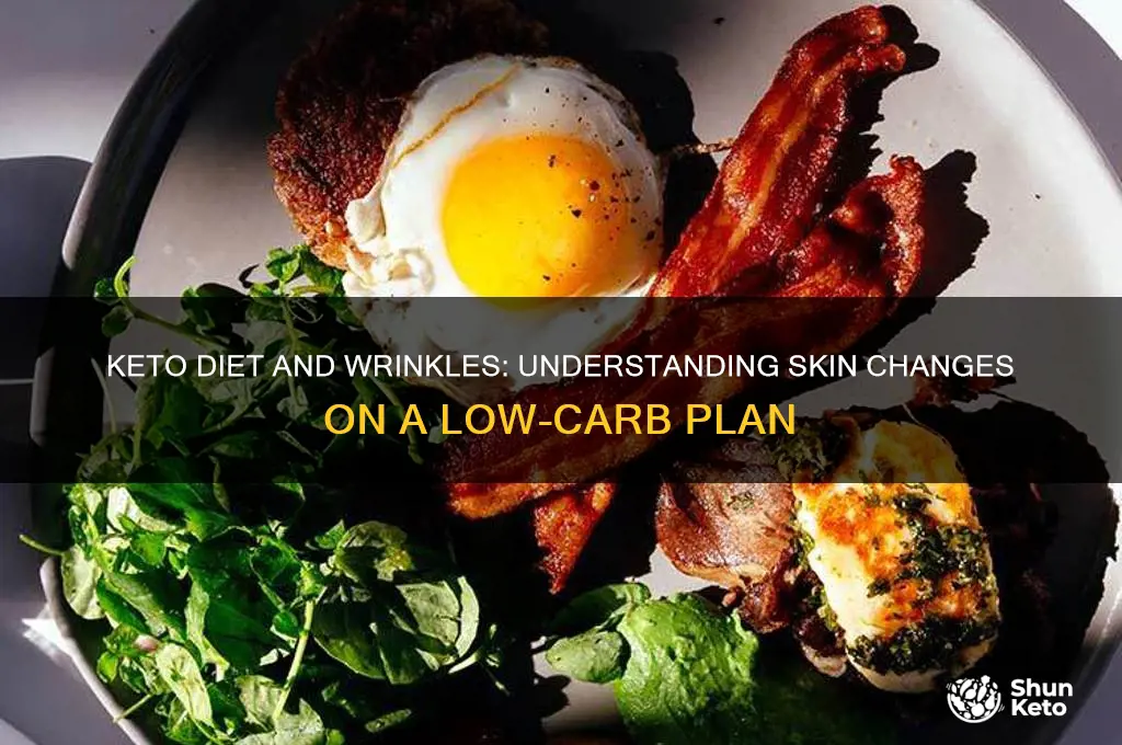 why am i getting wrinkles on keto diet
