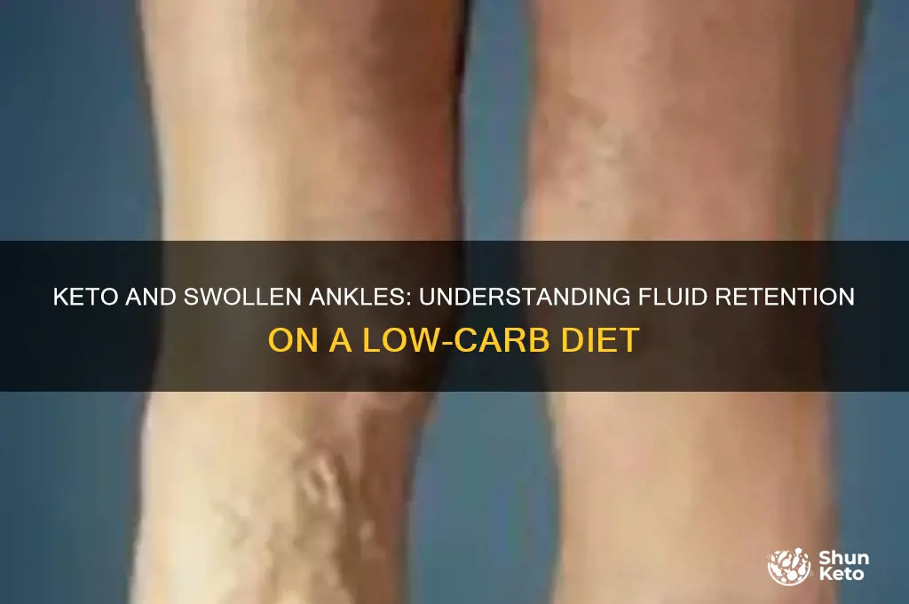 why are my ankles swollen on keto diet