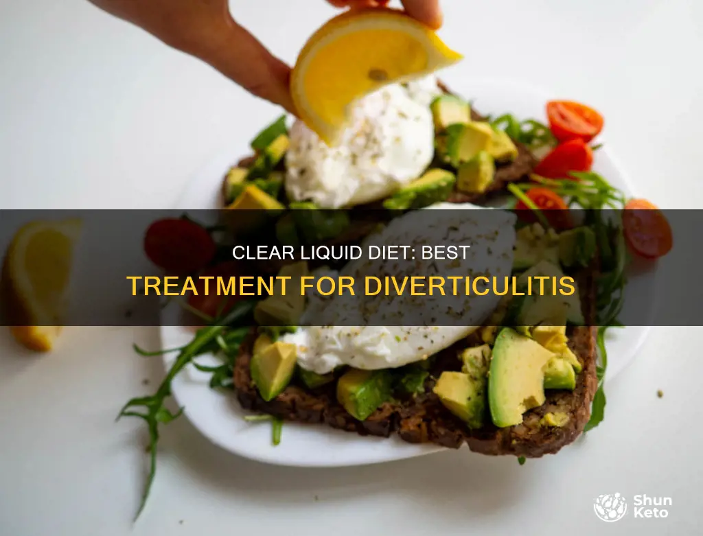 why clear liquid diet for diverticulitis