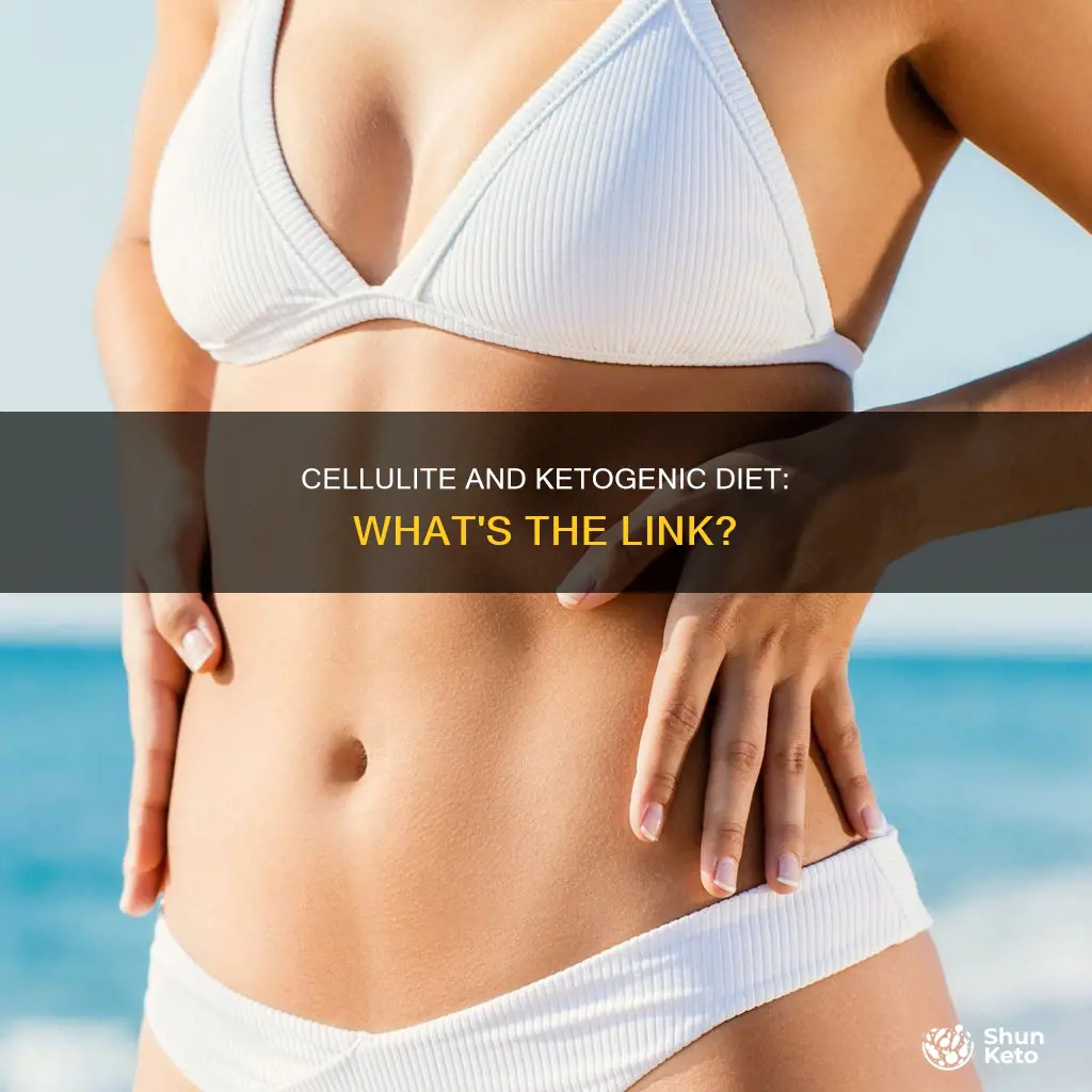 why does cellulite look worse on a ketogenic diet