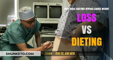 Gastric Bypass: Weight Loss Surgery vs Dieting