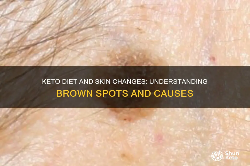 why dows keto diet cause brown spits on skin