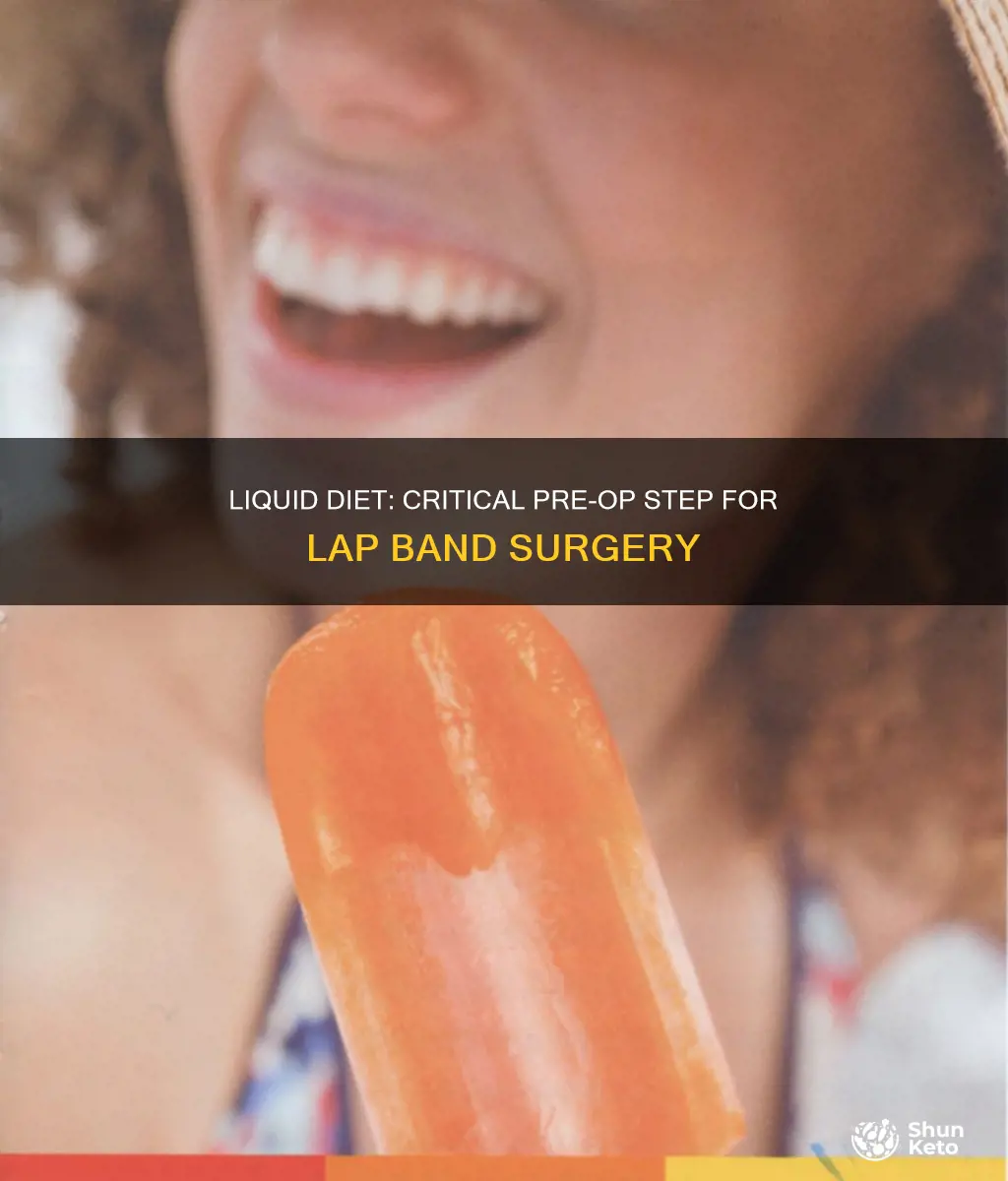 why is liquid diet important before lap band surgery