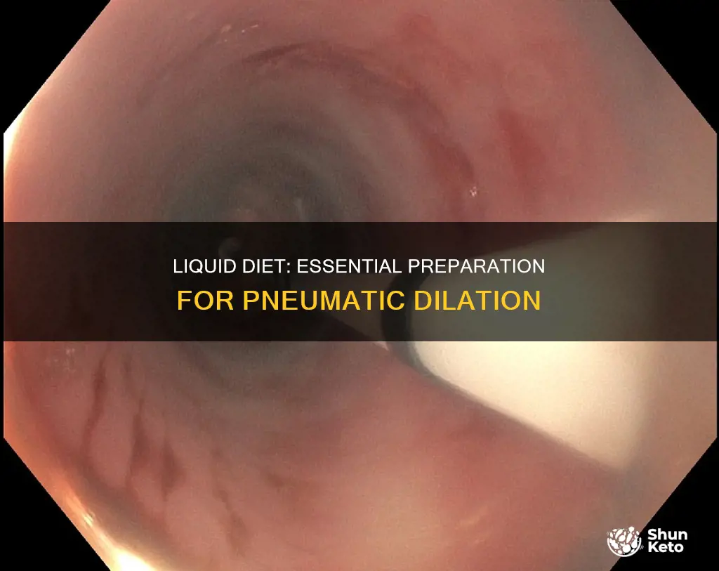 why liquid diet before pneumatic dilation
