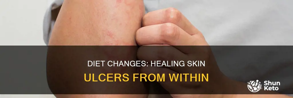 why would changing your diet help with a skin ulcer