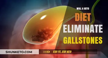 Can Keto Diet Help Prevent or Eliminate Gallstones?