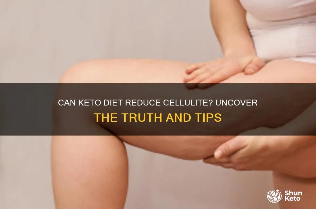 will a keto diet help get rid of cellulite
