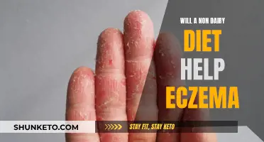 Non-Dairy Diets: Eczema's Friend or Foe?