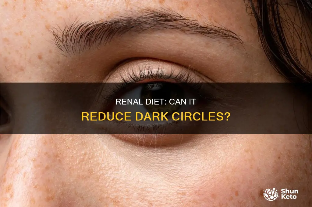 will a renal diet improve dark circles