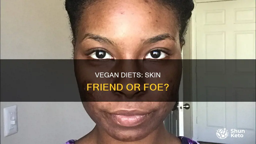 will a vegan diet help my skin