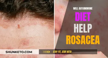 Autoimmune Diet: A Rosacea Cure?