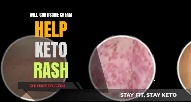 Cortisone Cream: A Quick Fix for Keto Rash?