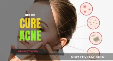 Diet's Impact: Can It Cure Acne?