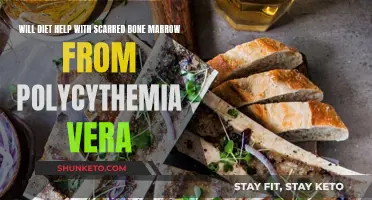 Healing Scarred Bone Marrow: Can Diet Help?
