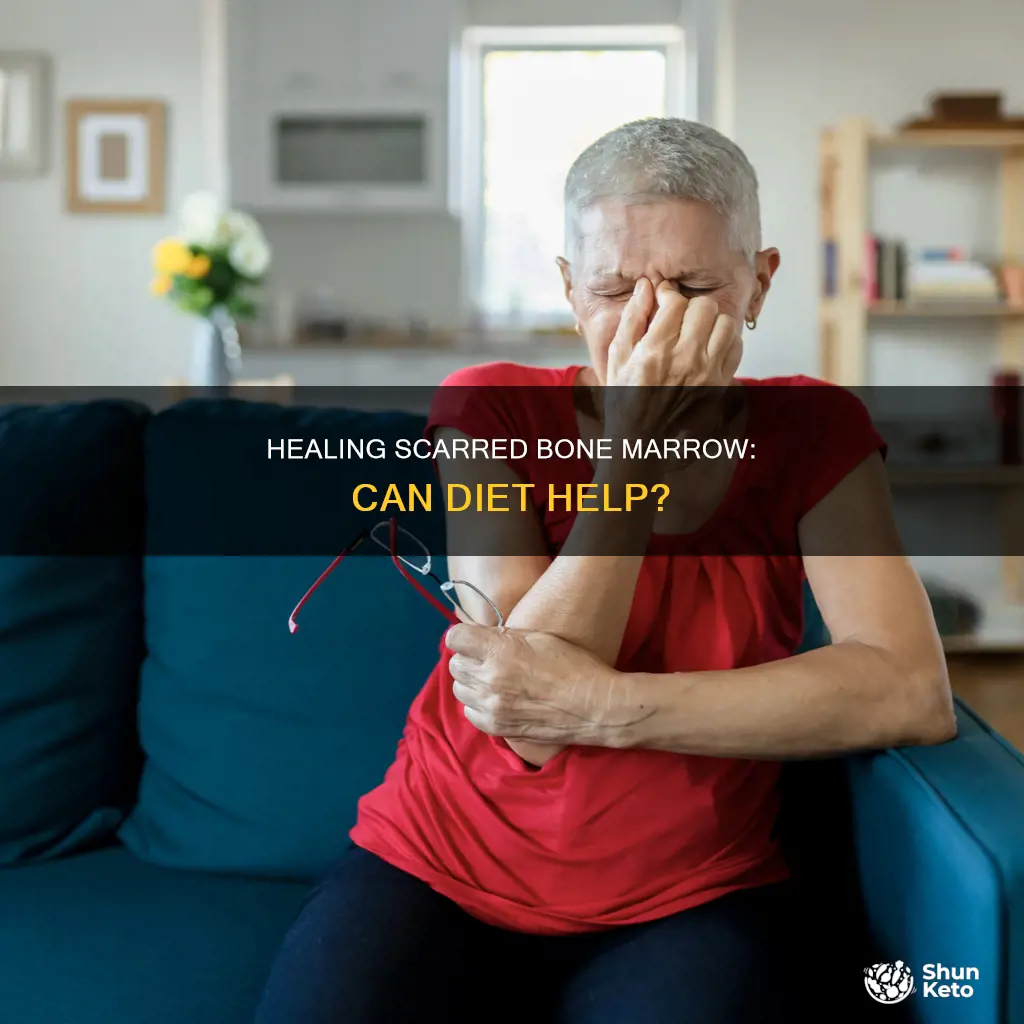 will diet help with scarred bone marrow from polycythemia vera