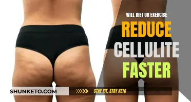 Diet vs. Exercise: Which Wins the Cellulite Battle Faster?