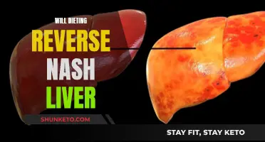 Dieting's Impact on Nash Liver: Reversing Damage or Making It Worse?