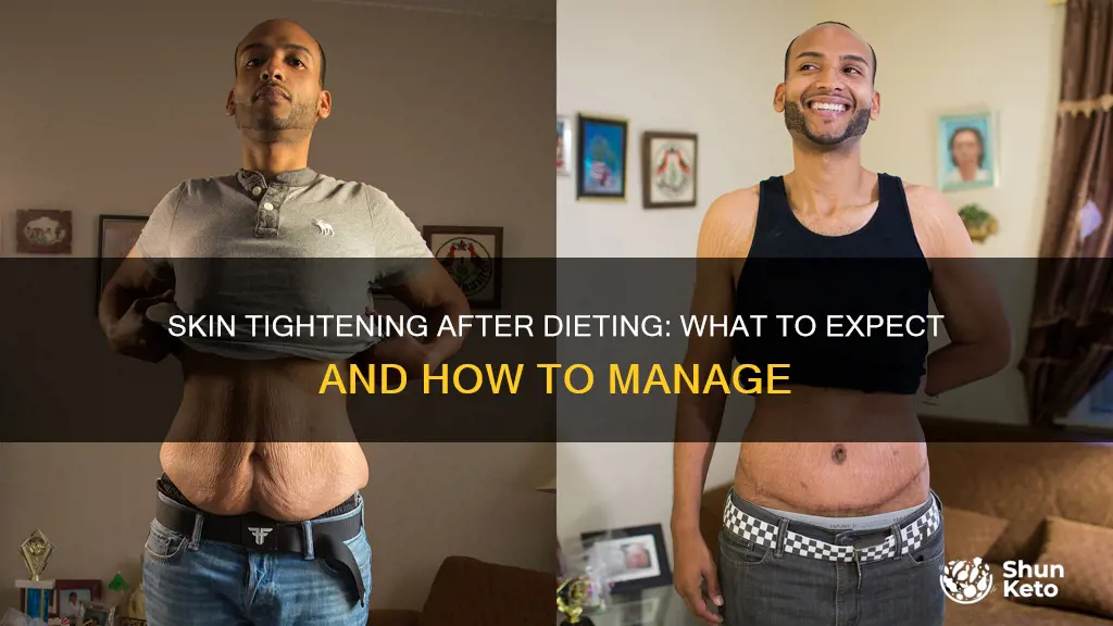 will excess skin from dieting go away