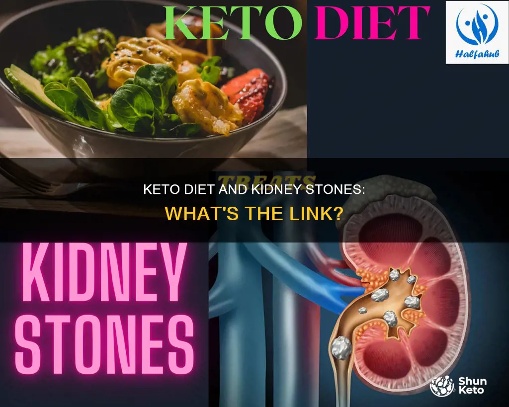 will foinf keto cause kidney stones