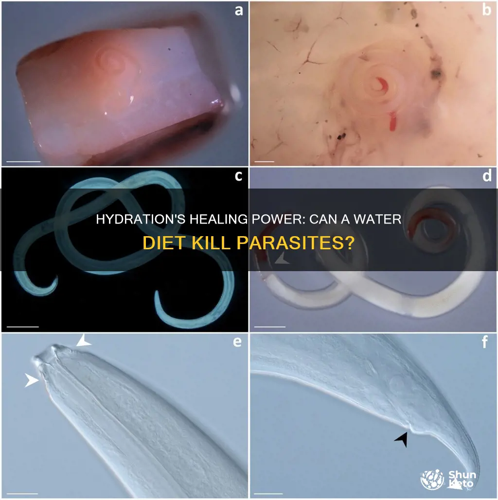 will going on a water diet kill parasites