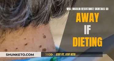 Skin Tags and Insulin Resistance: Diet's Impact and Treatment