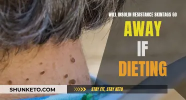 Insulin Resistance and Skin Tags: Can Dieting Help?