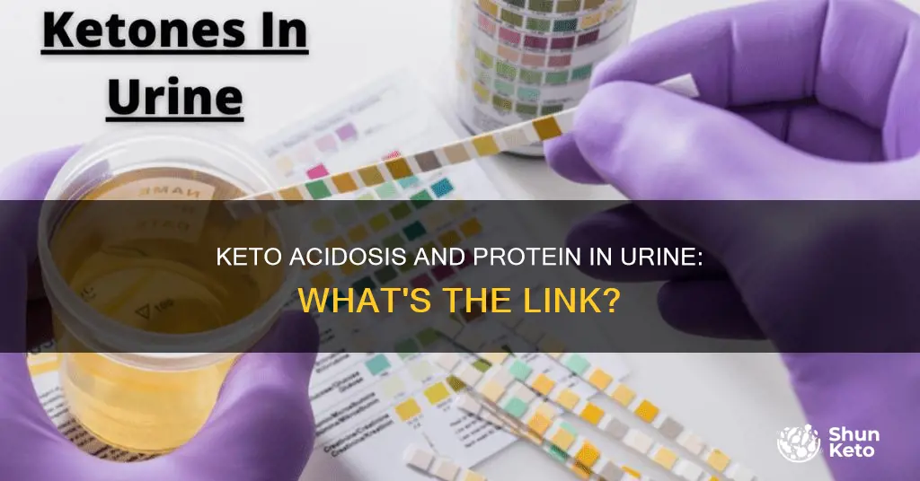 will keto acidosis cause protein in urine