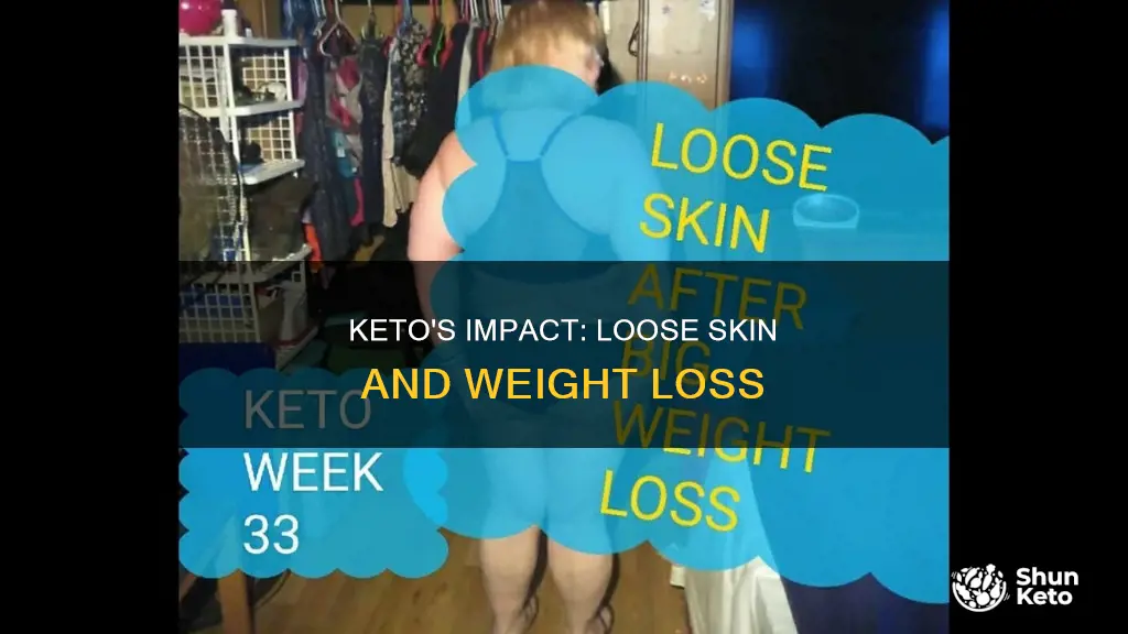 will keto cause saggy skin