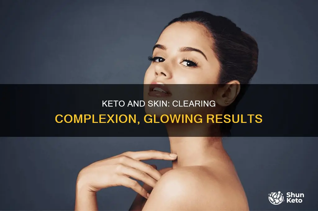 will keto clear skin