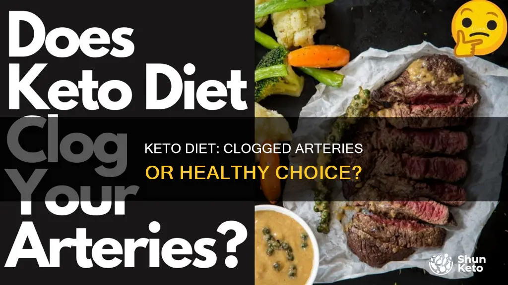 will keto clog arteries