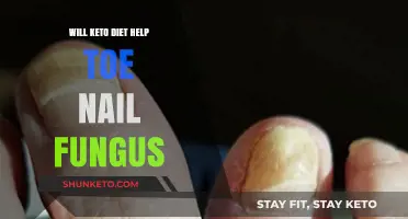 Can Keto Diet Combat Toenail Fungus? Exploring the Connection