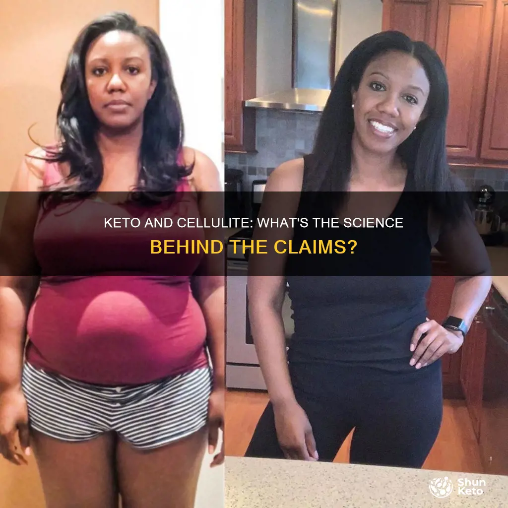 will keto help with cellulite