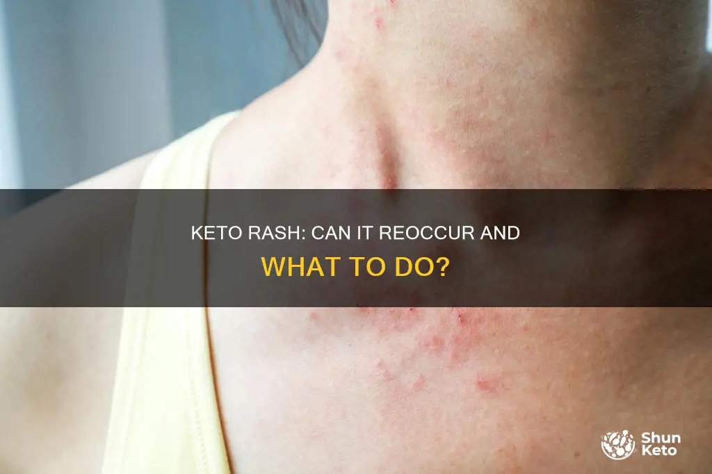 will keto rash come back