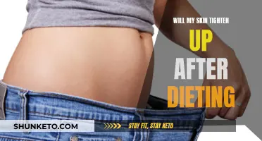 Skin Elasticity: Dieting and Skin Tightening Explained