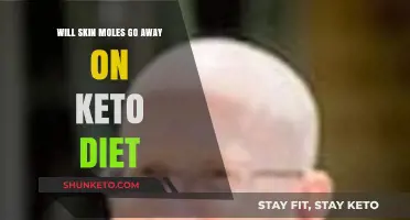 Can Keto Diet Help Reduce or Eliminate Skin Moles?