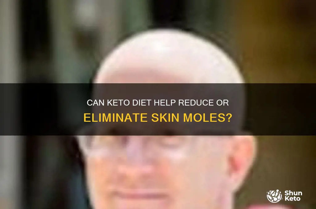 will skin moles go away on keto diet