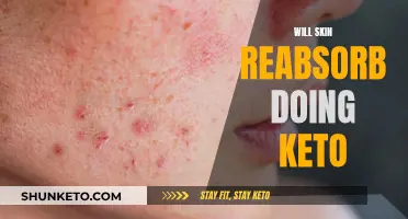 Skin Reabsorption While on Keto: What to Expect