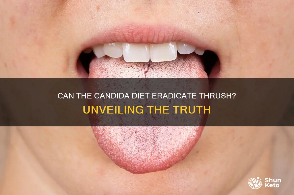 will the candida diet kill thrush