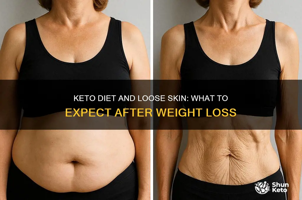 will the keto diet leave hanging skin down