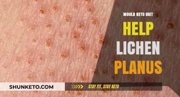 Keto Diet and Lichen Planus: Exploring Potential Benefits and Risks