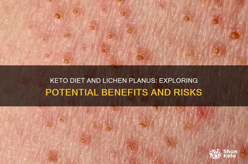 would keto diet help lichen planus