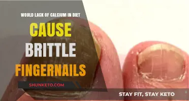 Calcium Deficiency: The Link to Brittle Fingernails