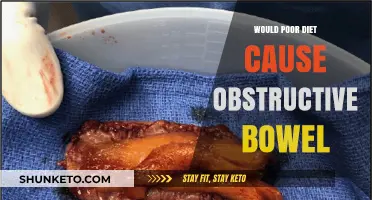How Diet Impacts Bowel Obstruction Risk
